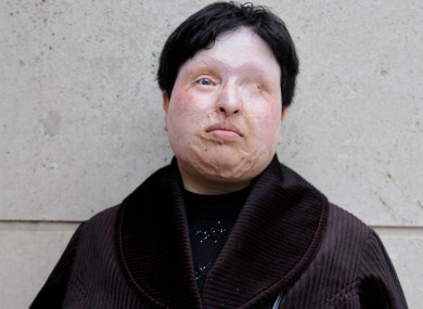 Ameneh Bahrami in 2009. She now lives in Spain.